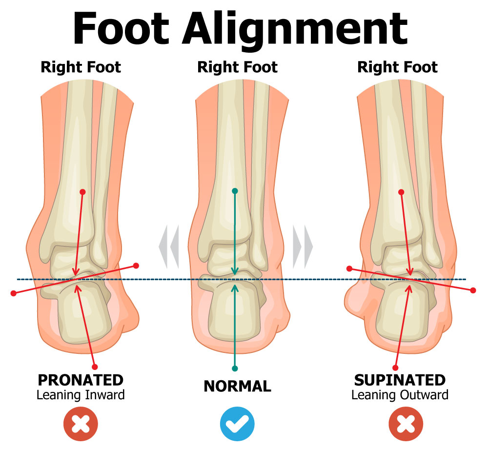 Foot Alignment Diagram